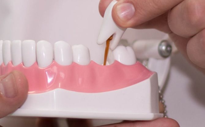 تصنيف الأطراف الصناعية ، أنواع أطقم الأسنان ، كيفية اختيار الأفضل