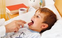 التهاب الفم عند الأطفال والرضع: الأعراض والعلاج والوقاية