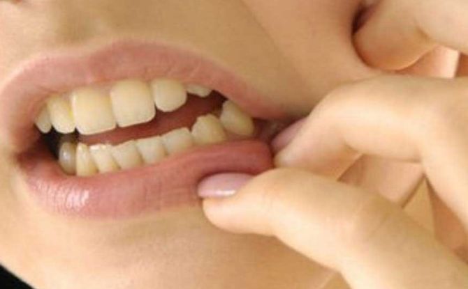 حكة الأسنان واللثة: الأسباب المحتملة لما يجب فعله