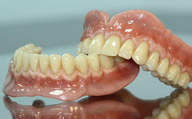أطقم الأسنان القابلة للإزالة: ما هي أنواعها وموادها وكيفية ارتدائها