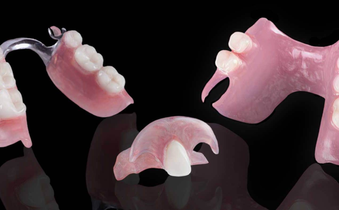 أطقم أسنان قابلة للإزالة وغير قابلة للإزالة مع غياب جزئي للأسنان: الأنواع والصور