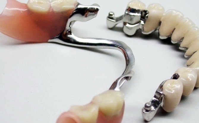 الأطراف الصناعية للأسنان ذات الأطراف الصناعية: ميزات التصميم وأنواعه وتكلفته