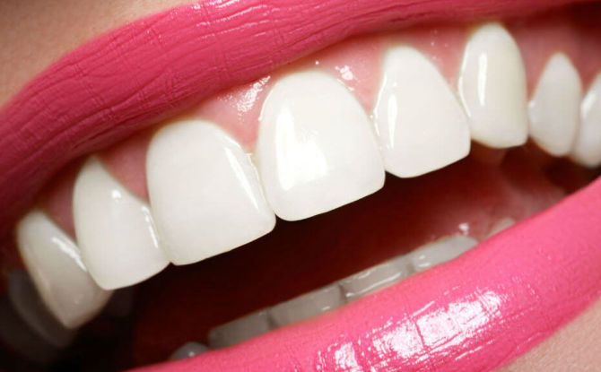 كيفية جعل الأسنان بيضاء في المنزل وفي العيادة ، وكيفية الحفاظ على أسنانها بيضاء