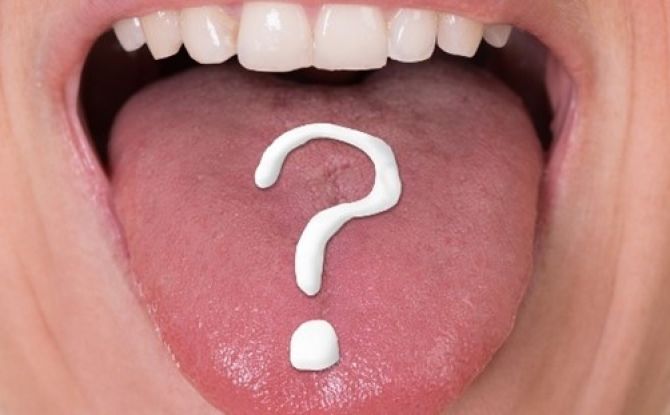 أمراض تجويف الفم واللسان: أنواع الأمراض وطرق علاجها