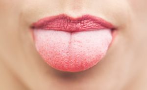 Boutons rouges sur la langue: à quel point elle est dangereuse et comment la guérir