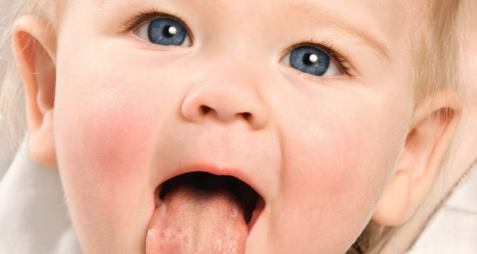 التهاب الفم عند الطفل